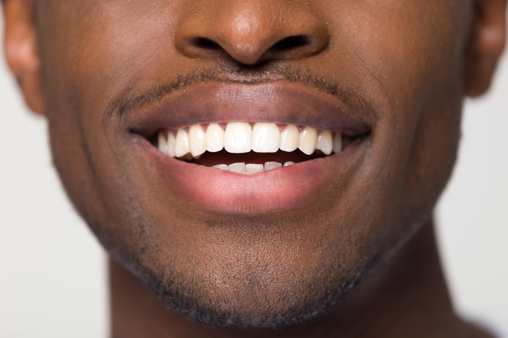 Alt Text: Close up of man's bright, white smile from teeth whitening in McLean, VA