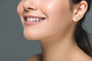 close up smile after orthodontics in McLean