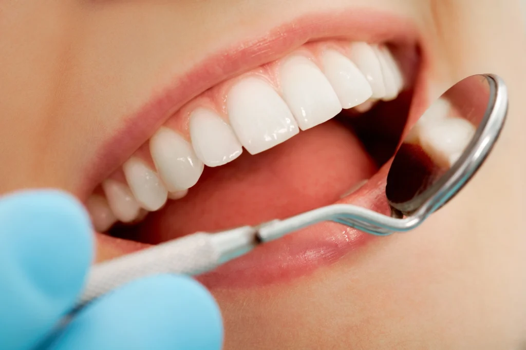 close up of smile at office of cosmetic dentists in Arlington
